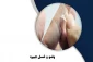 نحوه گرفتن وضو با دست چسبی 2