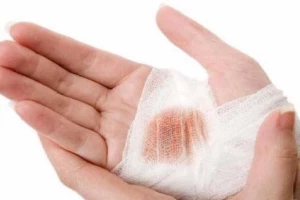 حالت‌های مختلف وضوی جبیره بر اساس نظرات رهبر انقلاب