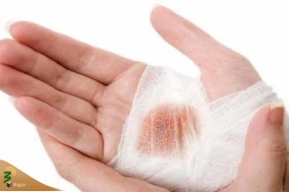 حالت‌های مختلف وضوی جبیره بر اساس نظرات رهبر انقلاب