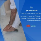 احکام شرعی | خشک بودن محل مسح 3
