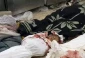 ۸۳ فلسطینی طی ۲۴ ساعت گذشته به شهادت رسیدند 2
