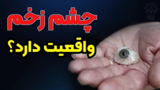 چشم زخم وجود دارد