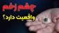 چشم زخم وجود دارد 2