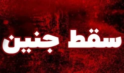 سقط جنین هشت ماهه مبتلا به بیماری 2