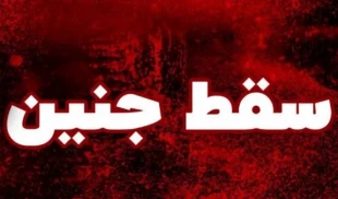 سقط جنین هشت ماهه مبتلا به بیماری 2