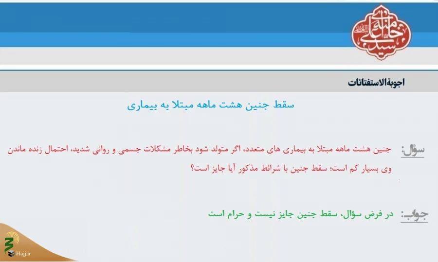 سقط جنین هشت ماهه مبتلا به بیماری 3